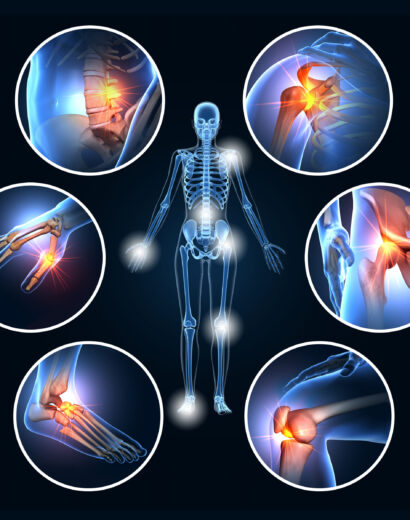 A set of six painful joints, medical 3D illustration